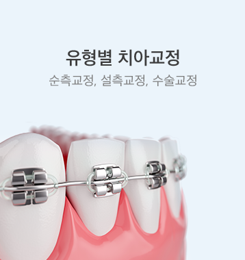 유형별 치아교정